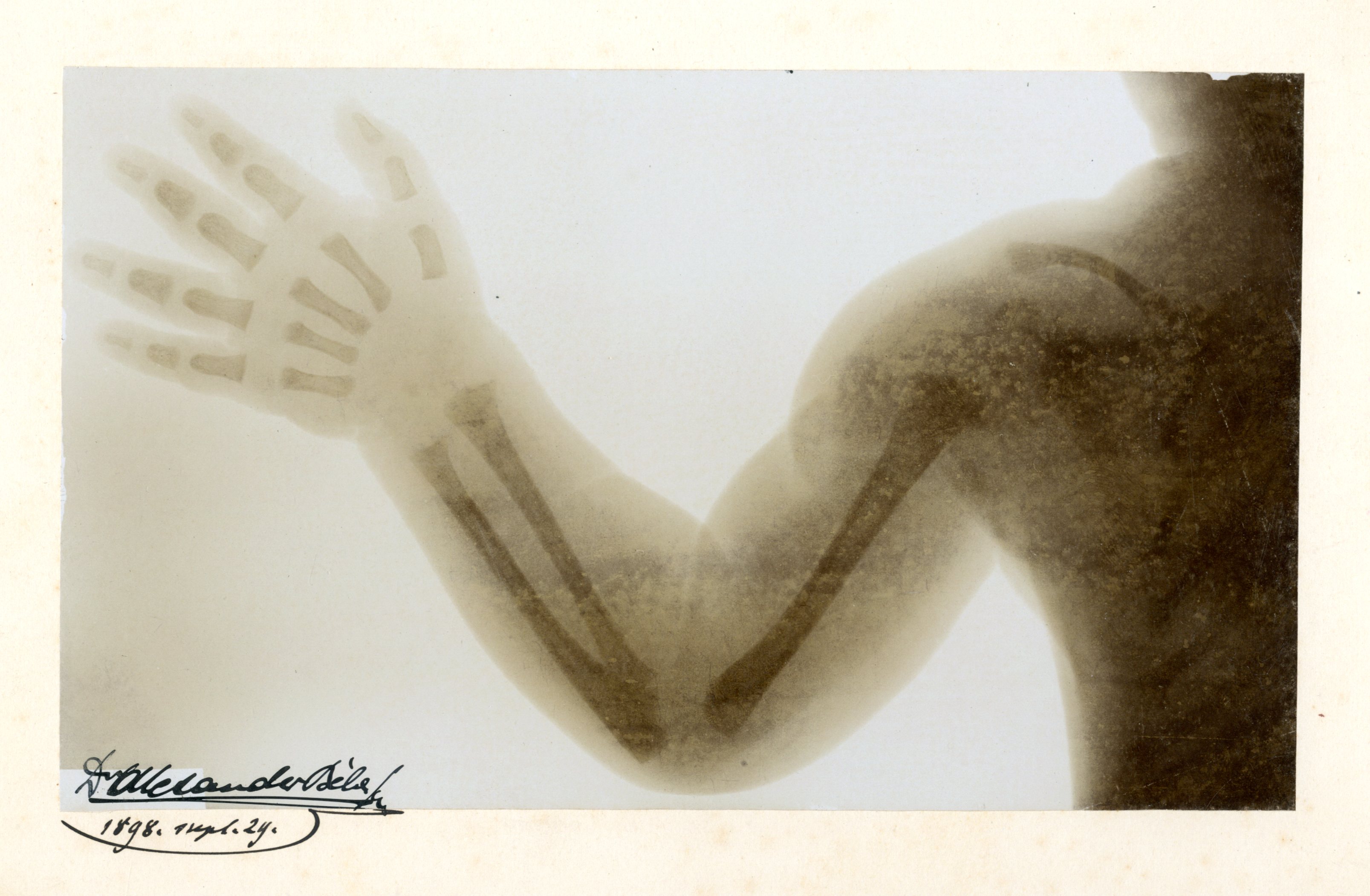 Foto č.1 röntgenovej snímky MUDr. Alexandra